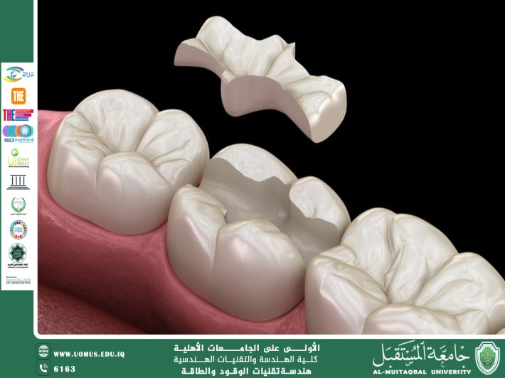 تقنيات استخدام النانو سيراميك في حشوات الاسنان