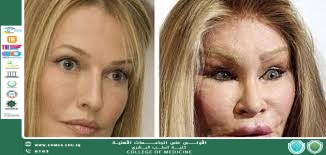 مقالة بعنوان التأثير السلبي لعمليات التجميل على النساء