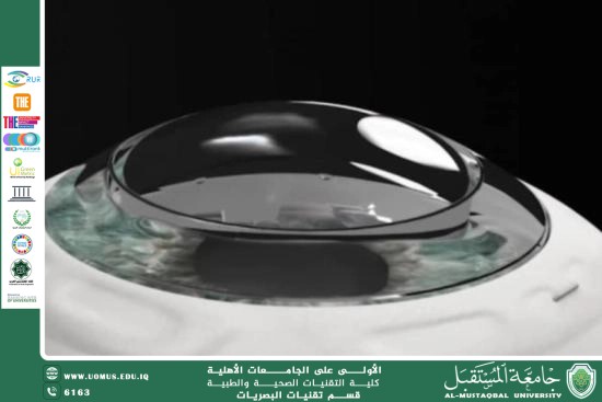 مقالة علمية للتدريسي م.م. علي هادي معيدي بعنوان القرنية الاصطناعية Keratoprosthesis