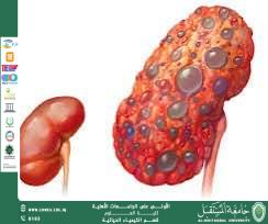 مقالة علمية للمعيدة حنين اياد بعنوان أمراض الكلى المزمنة: الكشف المبكر والاستراتيجيات الوقائية