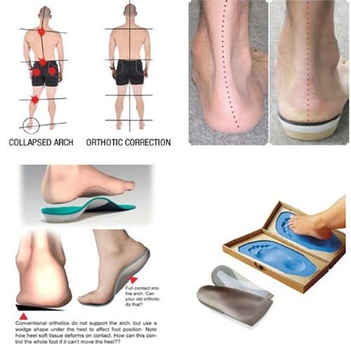 Problems with Orthotic Devices Resulting from Inaccurate Diagnosis