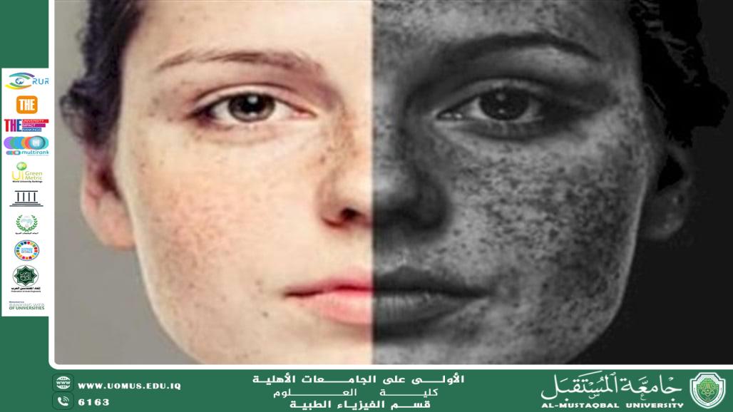 A scientific article by the teaching assistant (Iftikhar Thamer) entitled "The effect of ultraviolet rays on the skin in the summer"