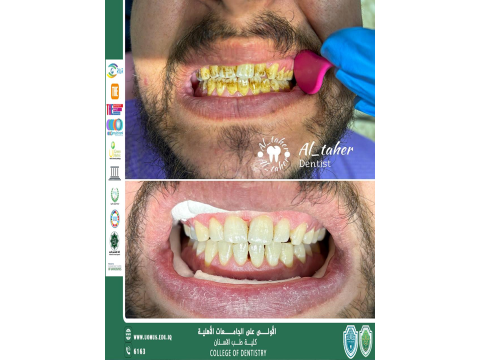 أبداع أحد طلبة كلية طب الأسنان المرحلة الخامسة في عملة داخل العيادات التعليمية 