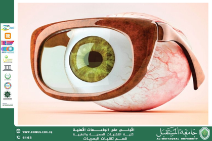 مقالة علمية للتدريسي أ.م.د منذر سمين شكر / م.م. مهيمن سمير عارف / م.م. علي هادي الحسيني (دور العدسات الطبية في تحسين جودة الحياة اليومية)
