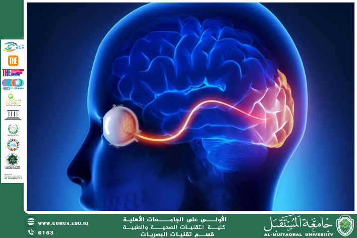 مقالة علمية للتدريسي م.م حسن قحطان كاظم الحسين  (تلف العصب البصري: الأسباب، الأعراض، التشخيص، والعلاج)
