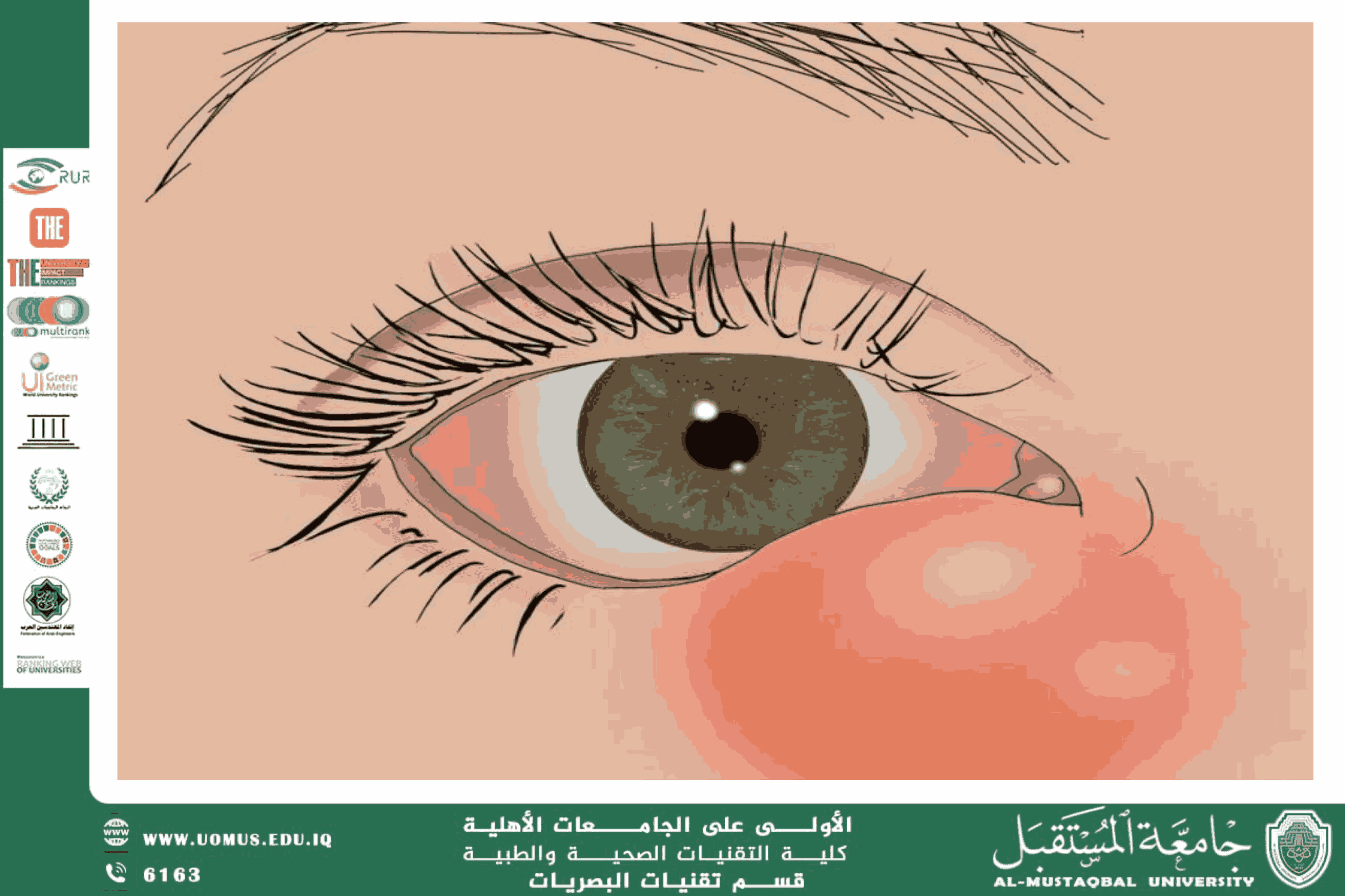 مقالة علمية للتدريسي م.م. علي هادي الحسيني (دور فحص السائل الدمعي في التشخيص المبكر للأمراض الالتهابية والمناعية للعين)