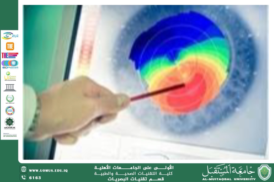 مقالة علمية للتدريسي مهيمن سمير عارف بعنوان (دور تقنيات تحليل الجبهة الموجية (Wavefront Analysis) في تشخيص وتصحيح العيوب البصرية الدقيقة: دراسة في تطبيقات البصريات الطبية الحديثة)