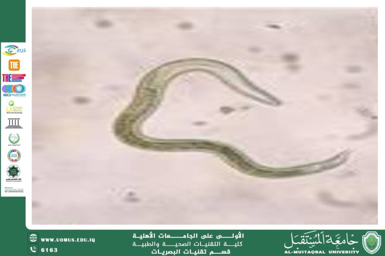 مقالة علمية للتدريسي حسن قحطان بعنوان (تأثير دودة الأسكاريس (Toxocara canis) على العين)