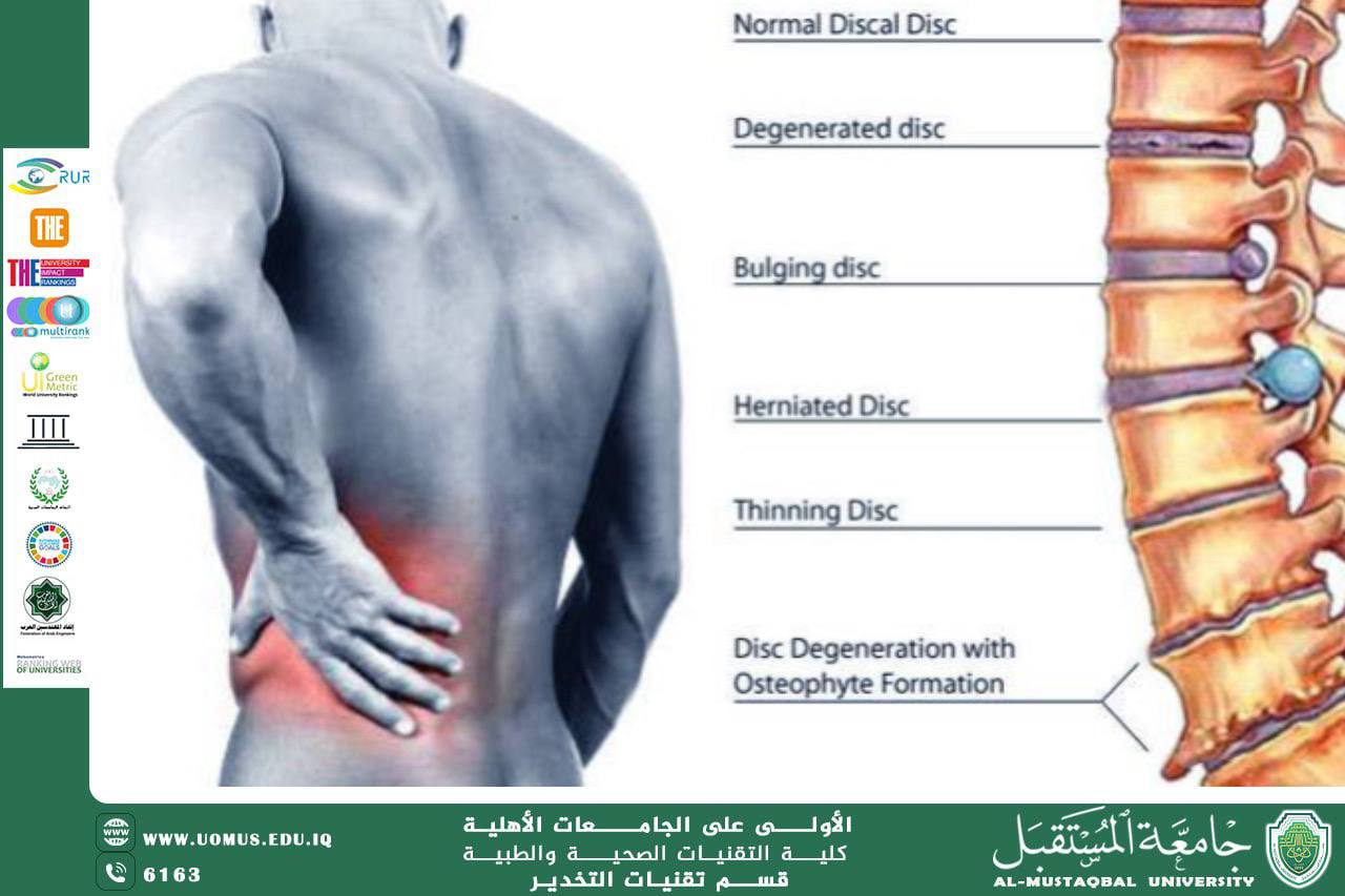 Spinal Anesthesia and Lumbar Spine Surgery