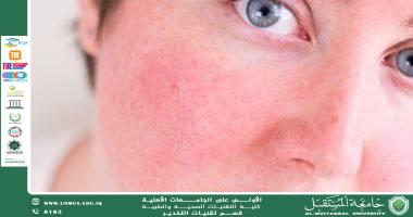 Allergies in Adolescents During Puberty: Causes and Immune Changes in the Hormonal Transition Phase