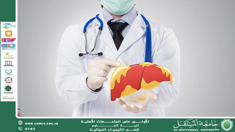 مقالة علمية لرئيس قسم الكيمياء الحياتية أ.د.ناصر عبد الحسن ناصر بعنوان علاقة اضطرابات الأيض بأمراض الكبد: نظرة طبية حديثة