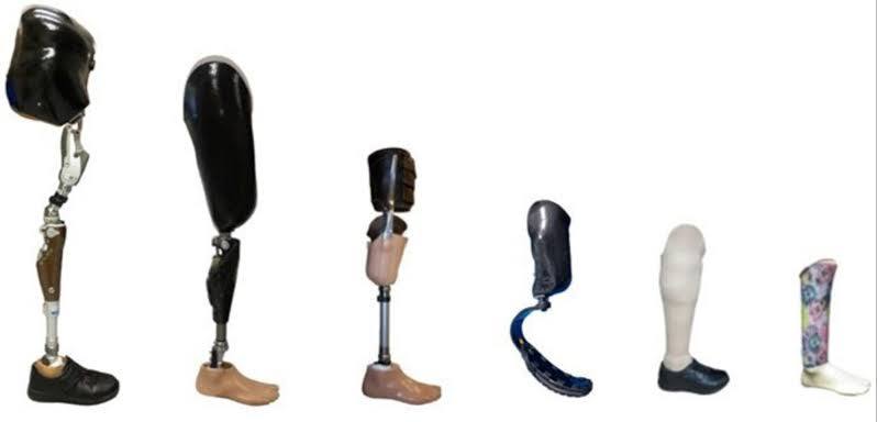 Medical Orthoses and Their Therapeutic Role