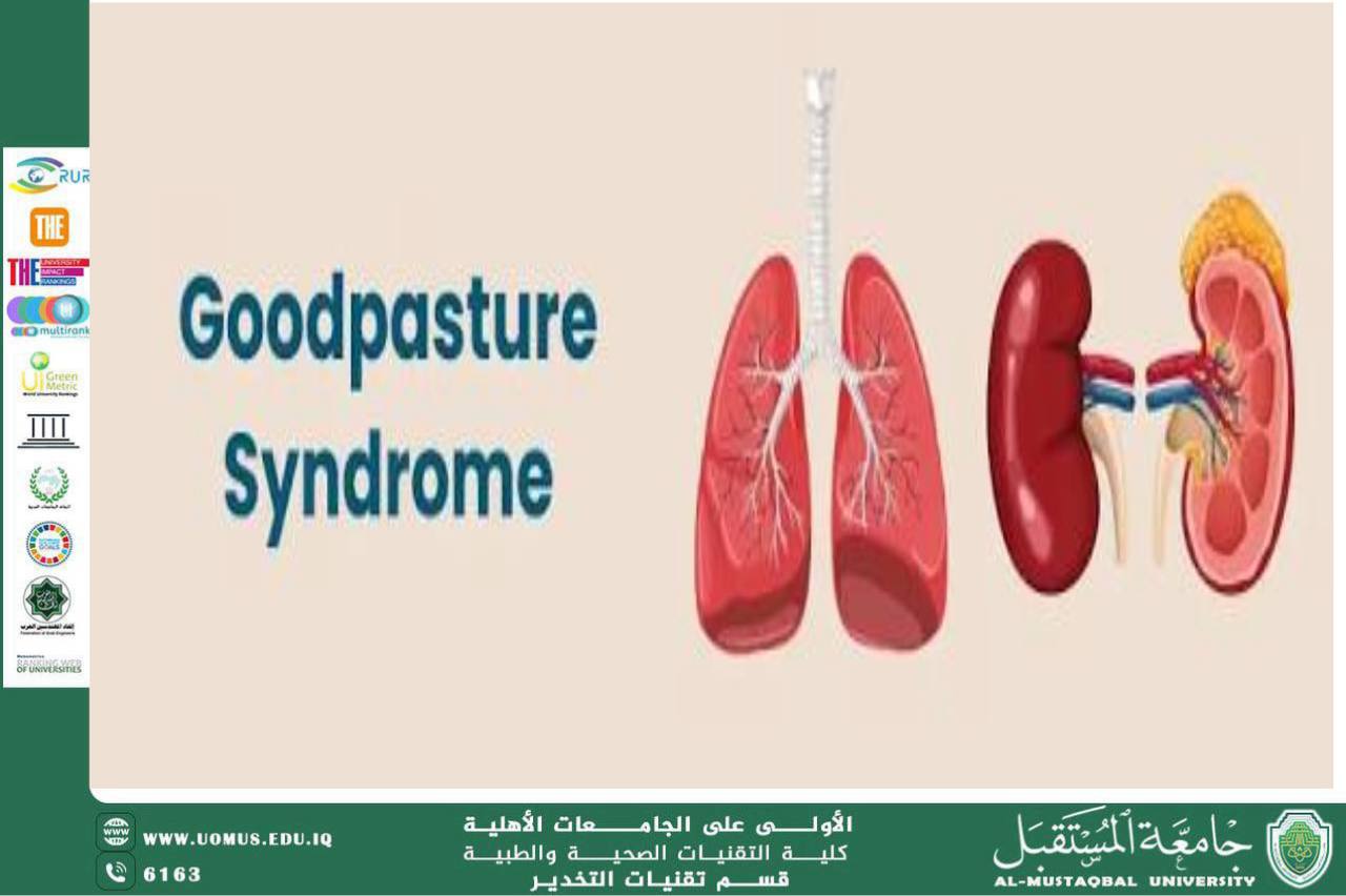 Goodpasture syndrome (GPS)