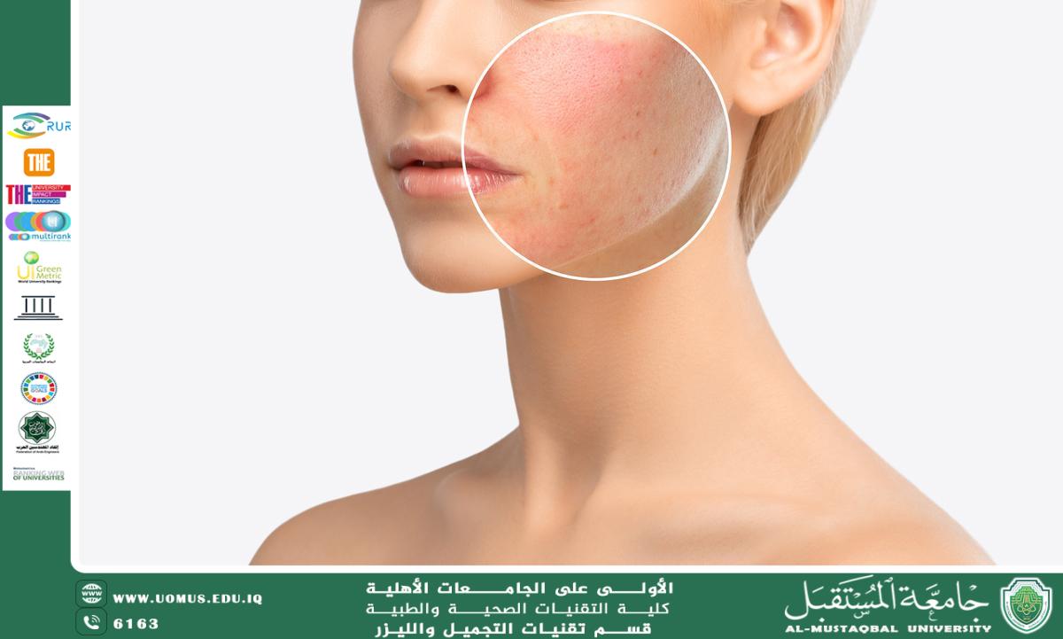 مقاله علميه للست هدى رافد عبد الخالق بعنوان الاستخدام الآمن لمستحضرات التجميل وصحة البشرة