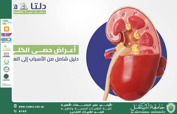 Diet and Kidney Stone Formation