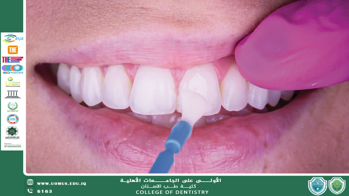 The Chemical Effect of Fluoride on Tooth Enamel