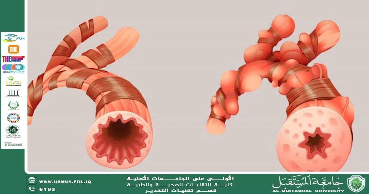 Bronchospasm – Scientific Article