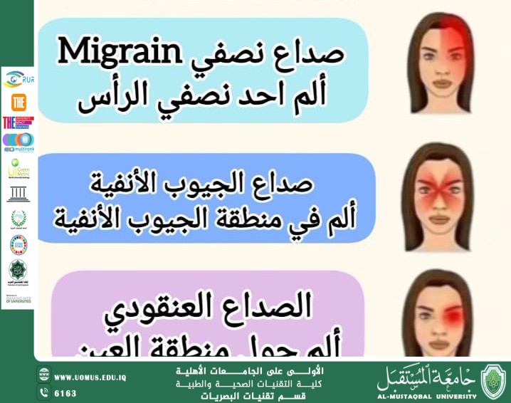 مقالة علمية للتدريسي غيث علي محمود بعنوان "تمييز الصداع العيني عن العصبي"