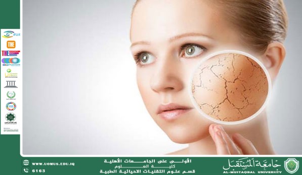 مقالة علمية للتدريسية (م.م سارة رحيم حمزة ) بعنوان "جفاف البشرة في الصيف"