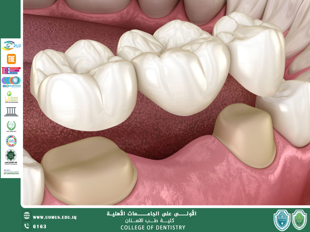 التيجان التلسكوبية