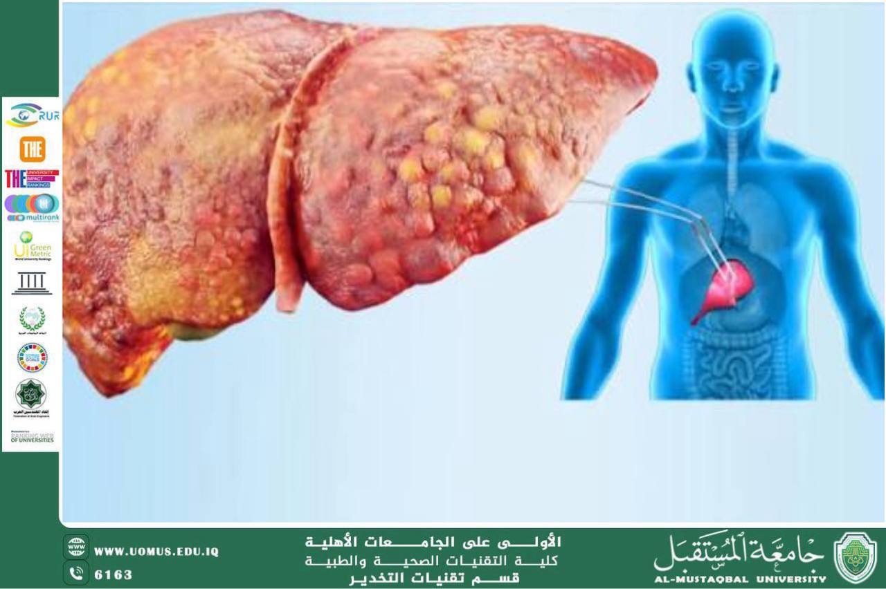 Fatty liver disease