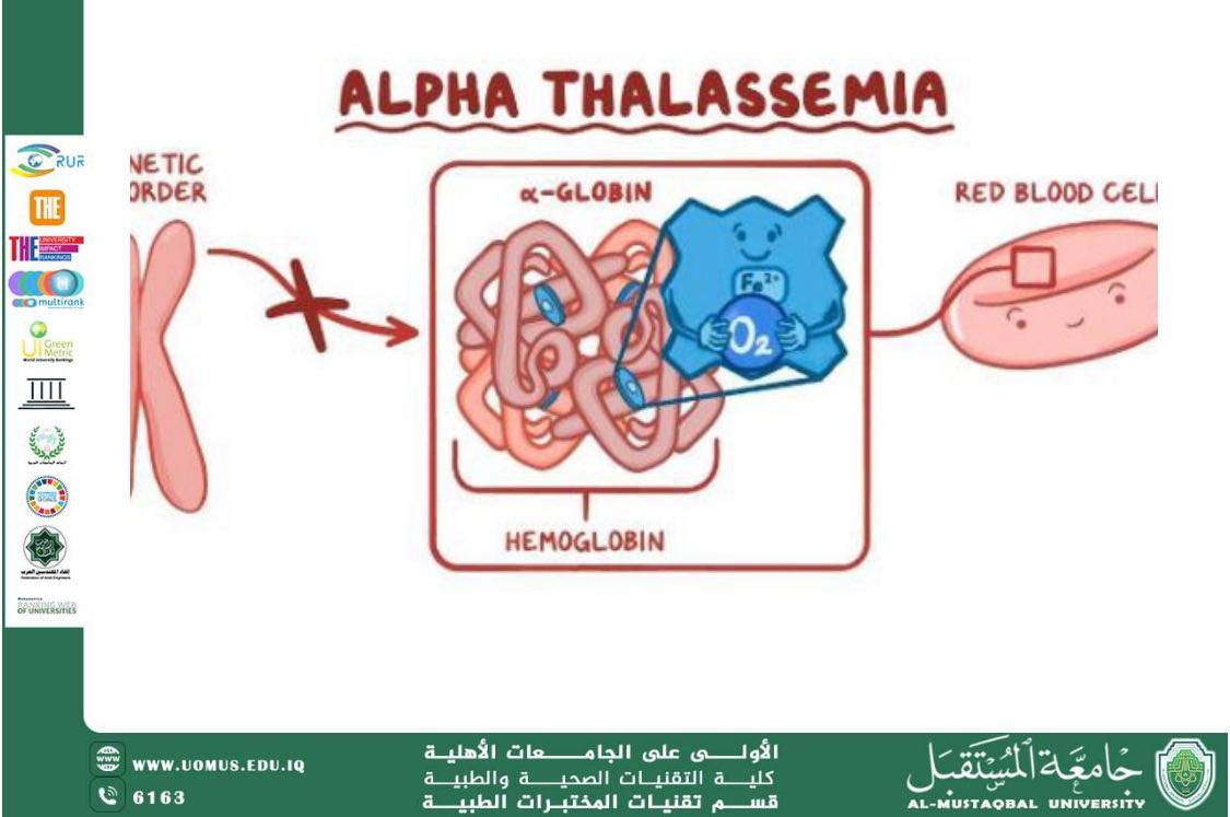 A Scientific Article by Ms. Zainab Mahmoud Hatem Titled: Thalassemia Disease