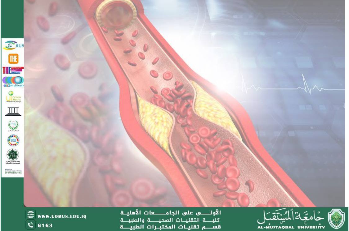 مقالة علمية للسيدة دعاء فاضل كاظم بعنوان مرض تصلب الشرايين عند المدخنين