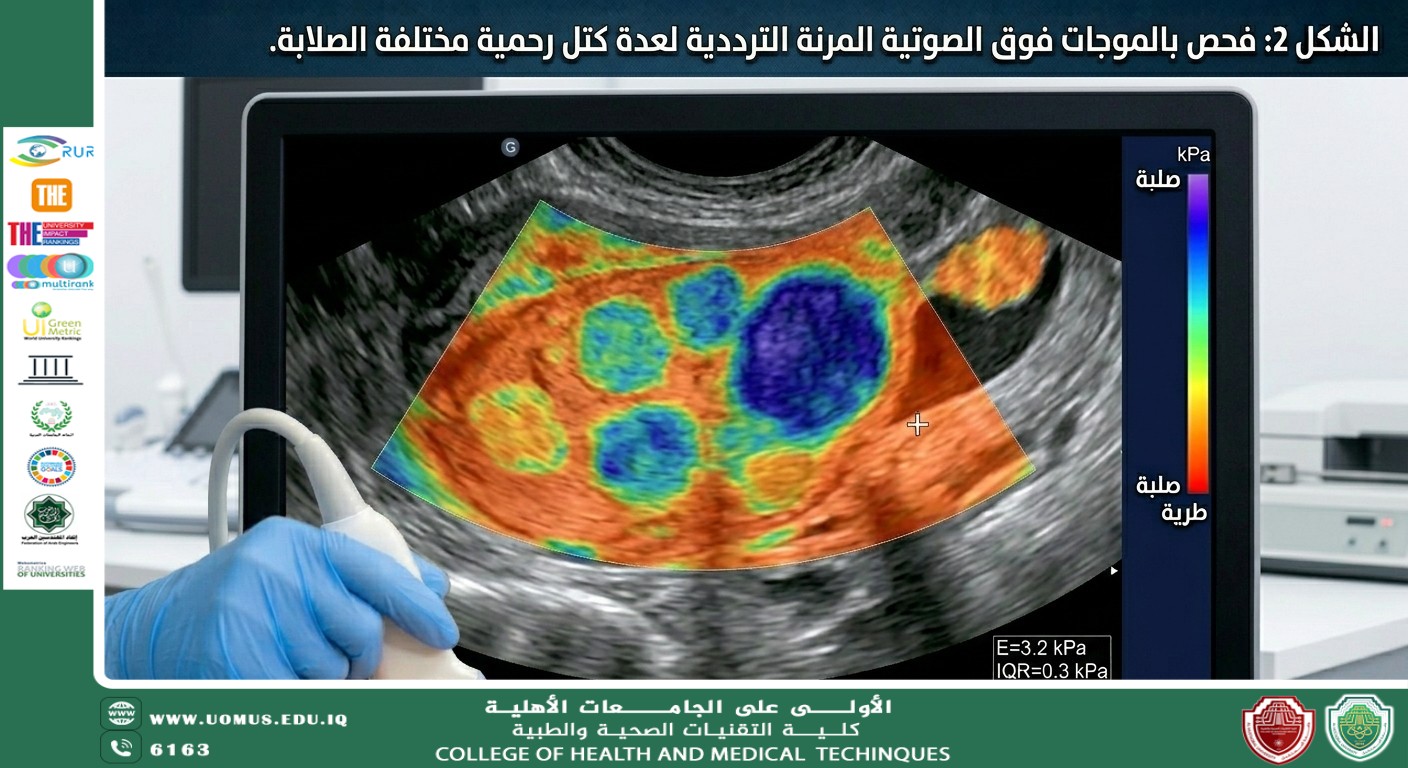 دور التصوير بالموجات فوق الصوتية المرنة (الترددية) في تشخيص الكتل الرحمية لدى النساء العراقيات