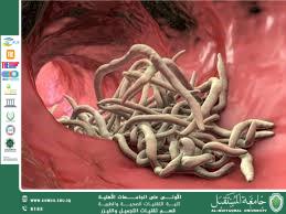A Scientific Article by the Head of the Department, Asst. Prof. Dr. Fatima Hashim Abbas  Title: Intestinal Parasites: Silent Enemies in the Digestive System
