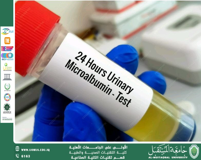 The Importance of the Microalbumin Test and Its Comparison with Creatinine and Estimated Glomerular Filtration Rate (eGFR) Tests  Prepared by: Professor Dr. Younis Abdul-Ridha Al-Khafaji