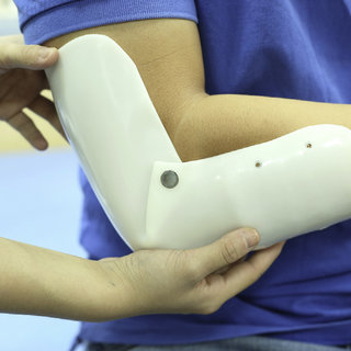 تقييم المريض قبل تصميم الطرف أو المسند