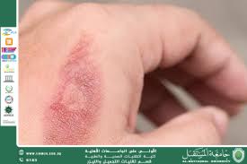 Complications in Aesthetic Laser Procedures and How to Prevent Them