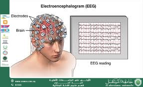 الجهاز العصبي وعلاج مرض الصرع (امير اسامة عدنان)