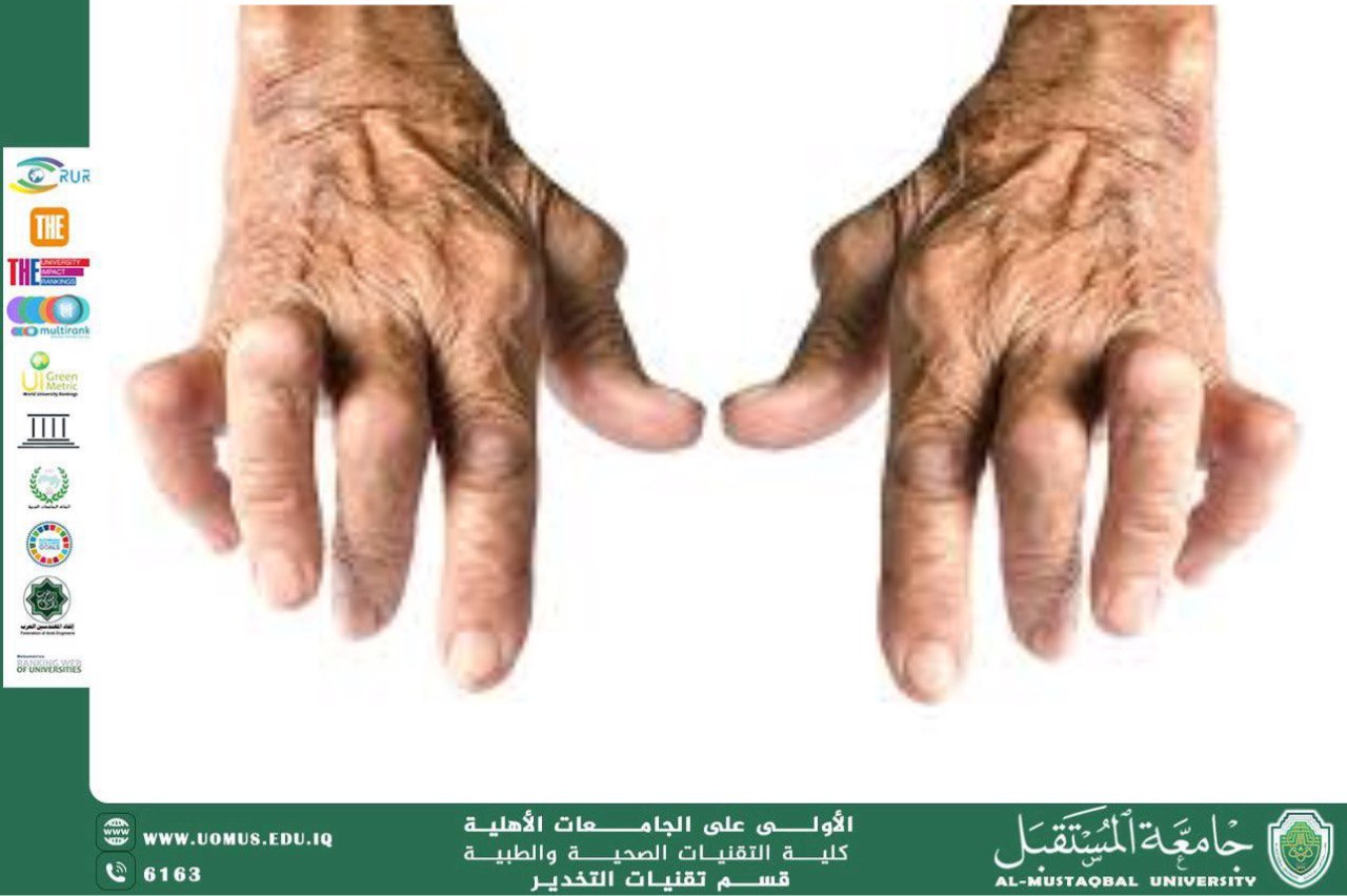 Rheumatism in the Elderly: Health Challenges and How to Manage Them