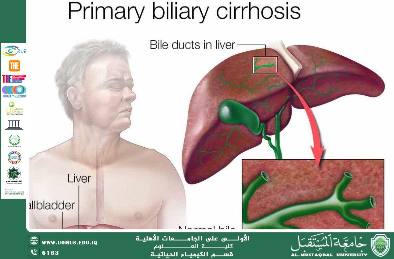 مقالة علمية بعنوان الأمراض المناعية للكبد: الآليات المناعية والحيوية المرضية من قبل التدريسي : م.م. عباس حمزة خضير
