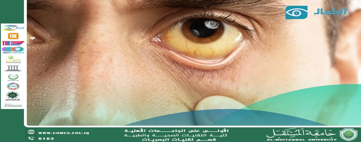 مقالة علميه لرئيس قسم تقنيات البصريات أ.م.د منذر سمين شكر بعنوان تأثير المخدرات على العين