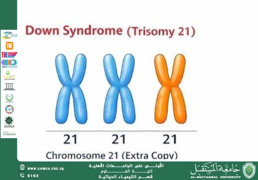 Gene Therapy Prospects for Down Syndrome: Can the Extra Chromosome Be Removed? Prepared by: Lect. Abbas Hamza Khudhair Department of Biochemistry – College of Science – Al-Mustaqbal University