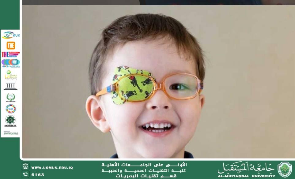 مقالة علمية للست ريهام صفاء نجم بعنوان كسل العين