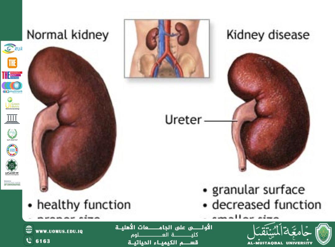 مقالة علمية للتدريسي م.م عباس حمزة خضير بعنوان العلاقة بين ارتفاع ضغط الدم والسكري وأمراض الكلى: منظور حيوكيميائي