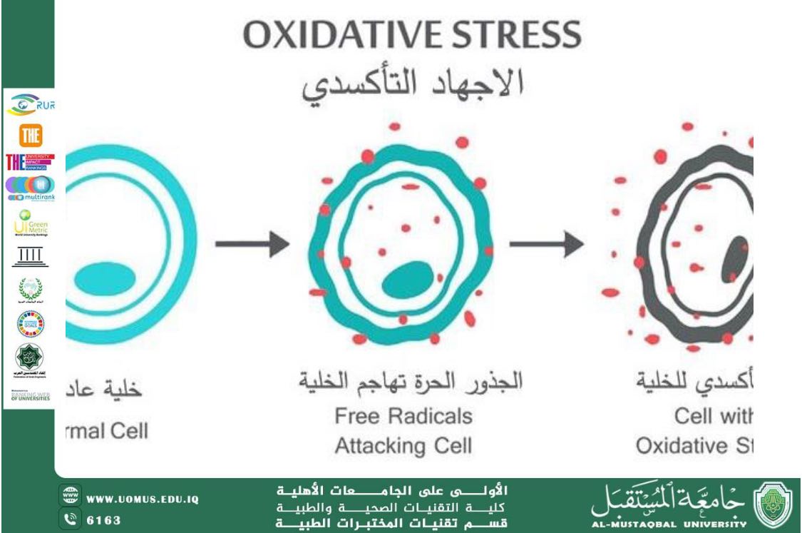 مقالة علمية للدكتورة ورود علي هذال بعنوان : الإجهاد التأكسدي وتأثيره على دهون الدم لدى المدخنين