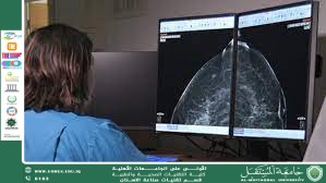 مقالة علمية (( دور الذكاء الاصطناعي في الكشف المبكر عن السرطان))