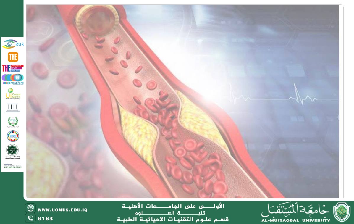 مقالة علمية بعنوان "مرض تصلب الشرايين عند المدخنين" للمعيد ( احمد جلال نعمه) .