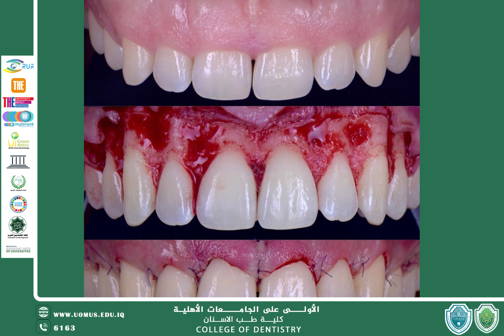 علم امراض وجراحة ما حول الاسنان