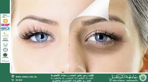 مقاله علميه للست هدى رافد عبد الخالق بعنوان الهالات السوداء حول العينين: الأسباب والحلول الفعّالة