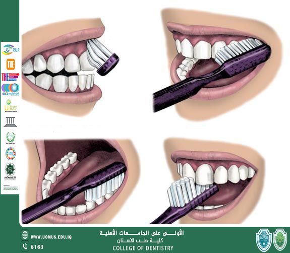تنظيف الأسنان الصحيح: أخطاء شائعة يجب تجنبها