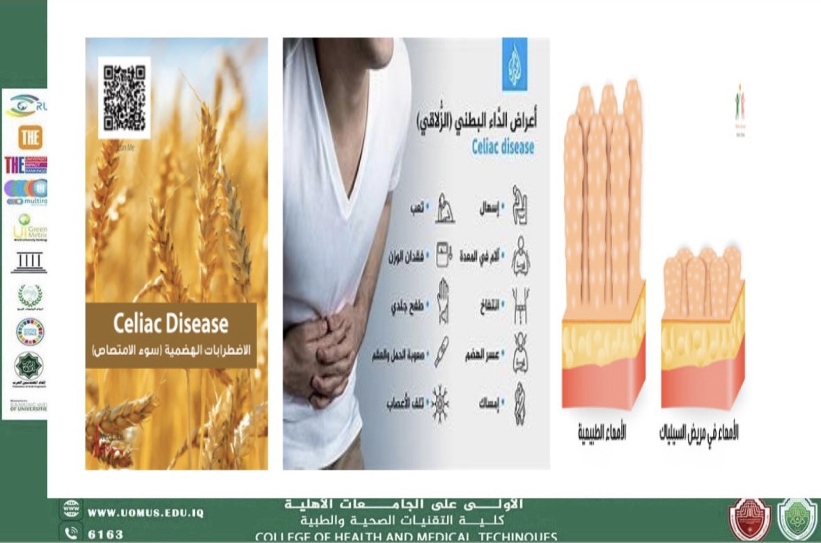 مرض سوء الامتصاص