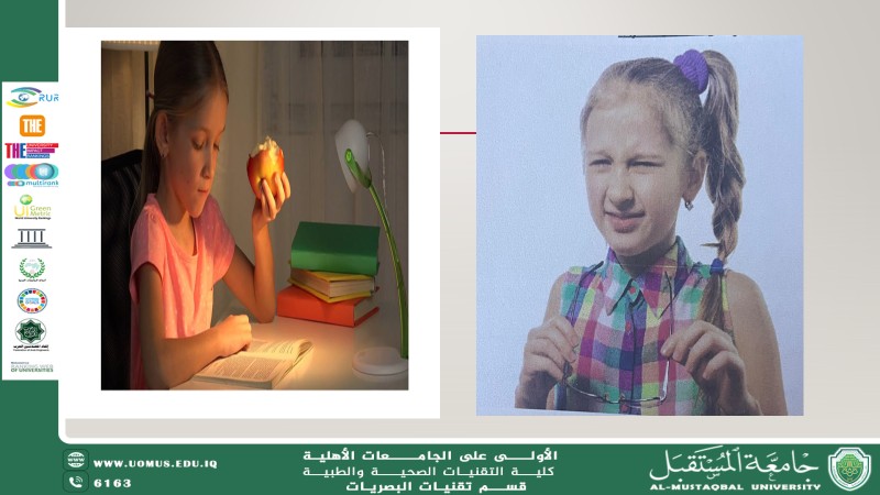 علاج جديد لتقليل انزعاج اطفال طيف التوحد من الضوء الساطع بالطلاء التدريجي لعدسة التضبيب