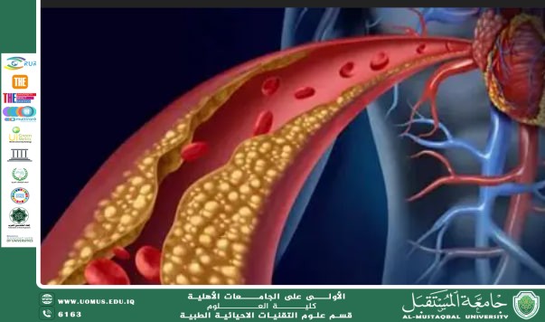 مقالة علمية بعنوان "مرض تصلب الشرايين عند المدخنين" ل(أحمد جلال نعمة ).