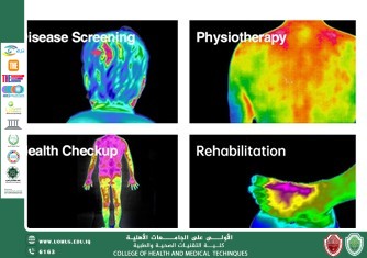 القضاء على البكتيريا الممرضة للجهاز البولي باستخدام المستخلصات النباتية
