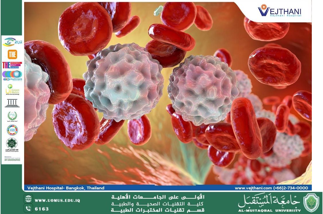 مقالة علمية بعنوان : سرطان الدم  سرطان الدم (اللوكيميا)